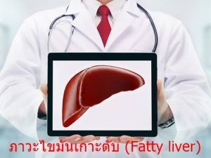 ภาวะไขมันเกาะตับ (Fatty liver)