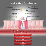 การปล่อยให้ลำไส้รั่ว หรือ Leaky gut นำไปสู่การเกิดโรคอะไรบ้าง