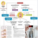 ทำไมผู้ป่วยโรคเบาหวาน จึงต้องถูกตัดขาด้วย?