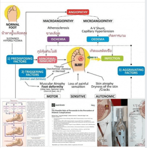 ทำไมผู้ป่วยโรคเบาหวาน จึงต้องถูกตัดขาด้วย?