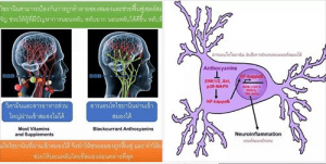 นอนหลับยาก ติดยานอนหลับ สารอาหารอะไรช่วยแก้ไขได้?