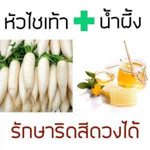 รักษาริดสีดวงด้วยสูตรหัวไชเท้า