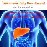 ไขมันพอกตับ (fatty liver disease) ตอน 1 สาเหตุของโรค