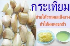 สูตร สมุนไพร รักษาผมหงอก ผมร่วง ง่ายๆ ด้วยกระเทียม ด้วยวิธีง่าย ๆ แบบนี้ ได้ผลชัวร์