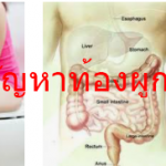 ใครกำลังมีปัญหาท้องผูก ต้องอ่านจ้า