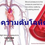 โรคความดันโลหิตสูง