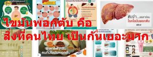 ไขมันพอกตับ คือ สิ่งที่คนไทย เป็นกันเยอะมาก