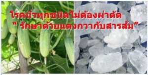 โรคนิ่วทุกชนิดไม่ต้องผ่าตัด “ รักษาด้วยแตงกวากับสารส้ม”