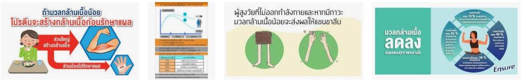 เรื่องน่ารู้ เกี่ยวกับ Sarcopenia